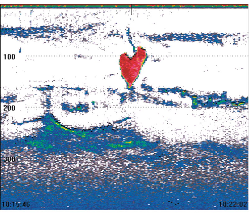 Figur 3.1 «Hjerteattakk».
