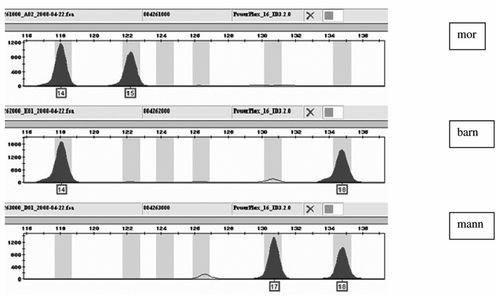Figur 4.1 Eksempel 1. Markør D3S1358 (PowerPlex16/Promega)