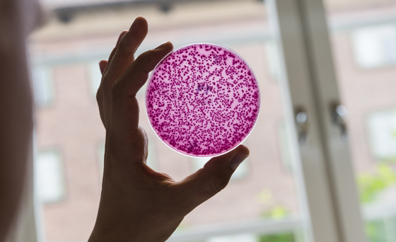 Veterinærinstituttet har fått EU-midler for å arbeide med forebygging og bekjempelse av antibiotikaresistens gjennom JPIAMR-programmet.