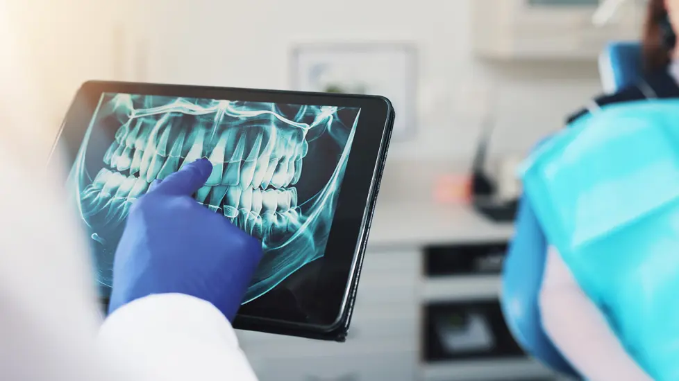 En lege holder opp et nettbrett med et røntgenbilde av en tanngard