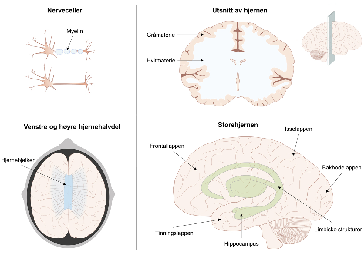 Figur 7.2 Illustrasjon av sentrale hjernestrukturer
