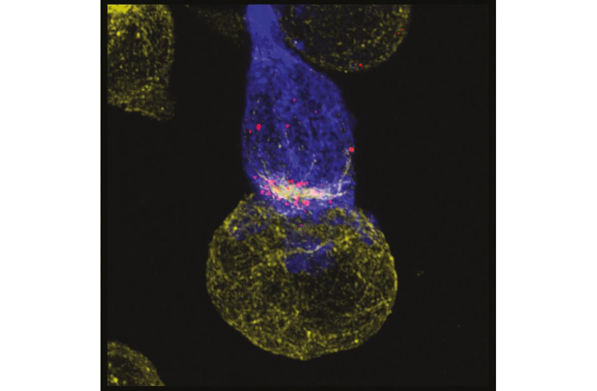 Figuren viser et mikroskopibilde av to celler, en gul kreftcelle og en blå immuncelle, der den blå cellen ligger helt inntil den gule cellen for å forsøke å drepe den.