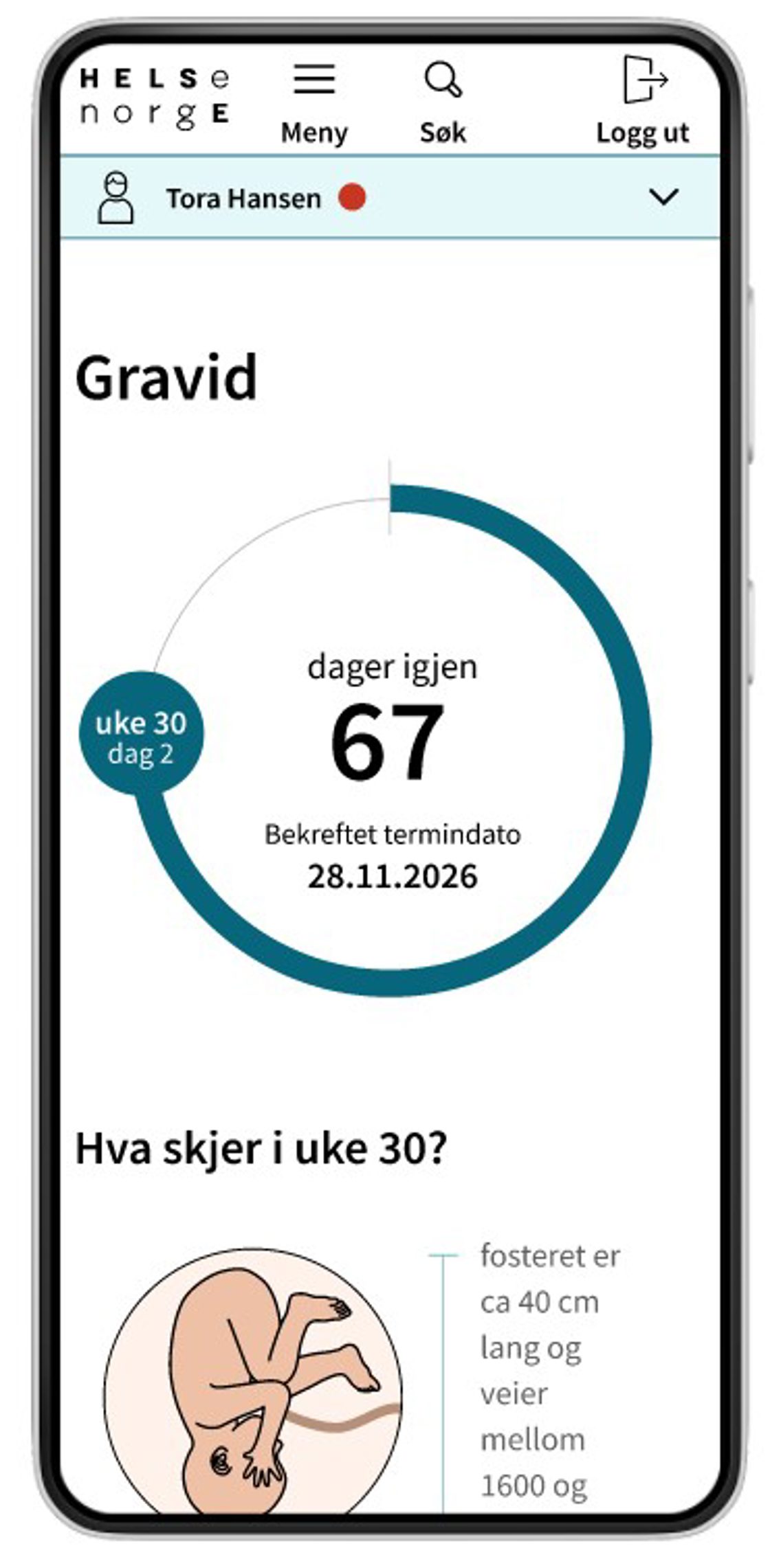Skjermbilde av digitalt helsekort for gravide