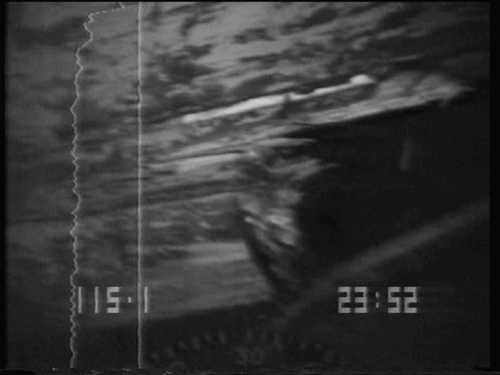 Figur 6.32 Skade i overgang baug/kjøl mot på styrbord
 side. Filmet i perioden 28. september – 2. oktober 1981.
