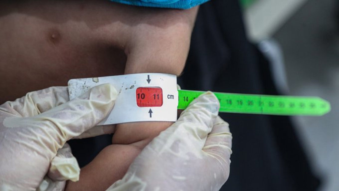 Jemen: Det ble advart mot å bruke humanitære tiltak for politisk gevinst. Foto: FN