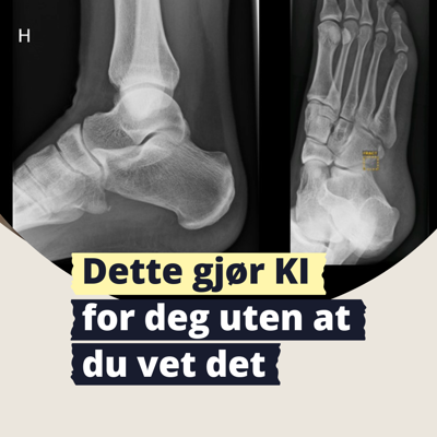 Et røntgenbilde av en fot