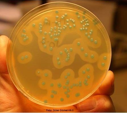 Listeria dyrket frem i laboratorium. Denne bakterien kan gjøre deg alvorlig syk.